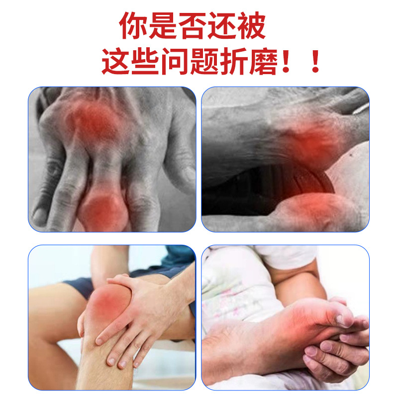 痛風(fēng)關(guān)節(jié)型 手指腳趾疼肩頸腰腿膝手肘疼痛酸麻痛風(fēng)型噴劑OEM代加工